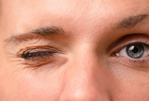 What causes right eye twitching